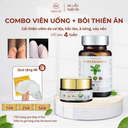(Combo 1) Kem Bôi Da + Viên Uống BoGan Thiên Ân