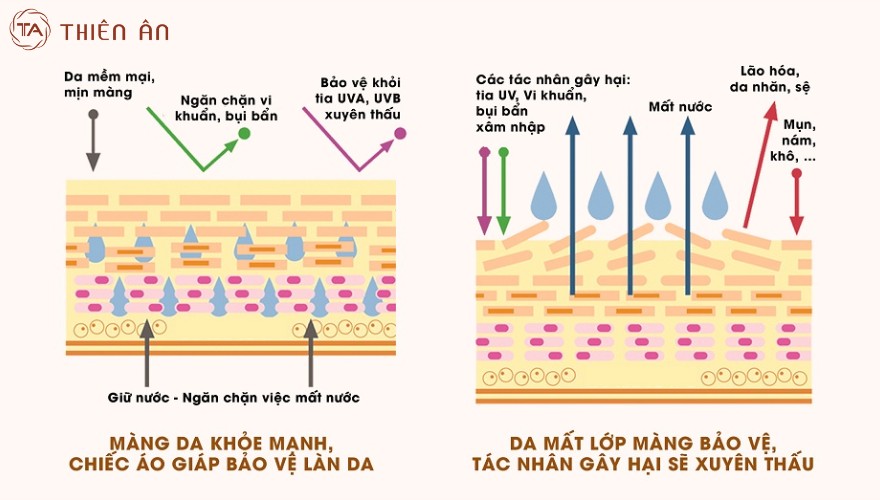 Thời tiết hanh khô khiến lớp sừng bị tổn thương, khiến da suy yếu