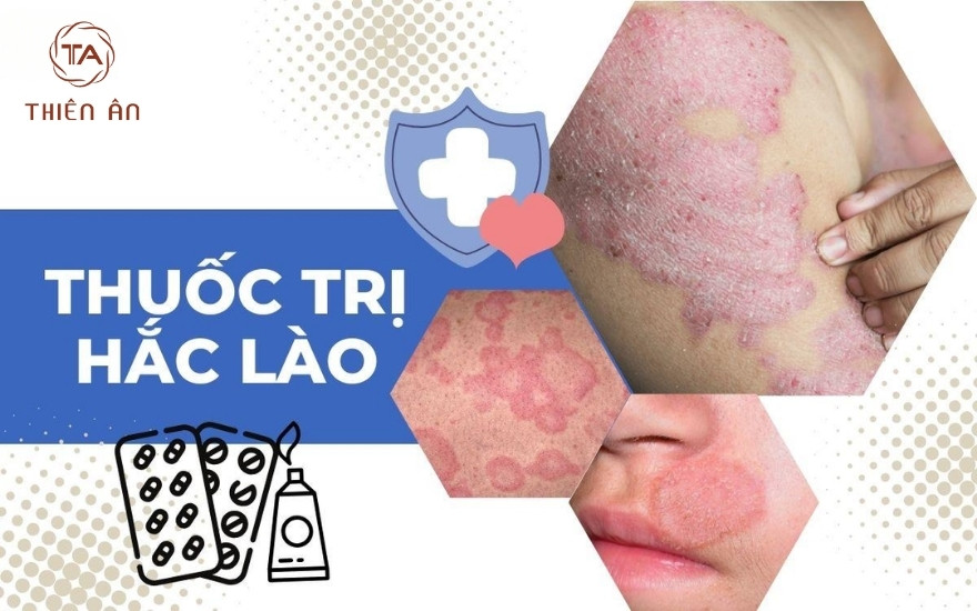 Thuốc trị hắc lào dạng uống